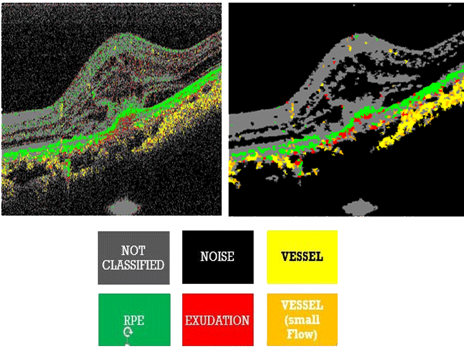 Tissue Classification